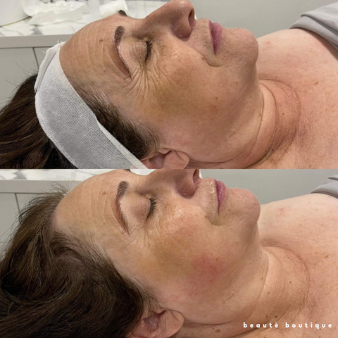 Signature Boutique Facial