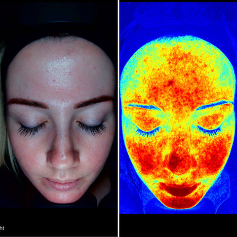 Skin Consultation