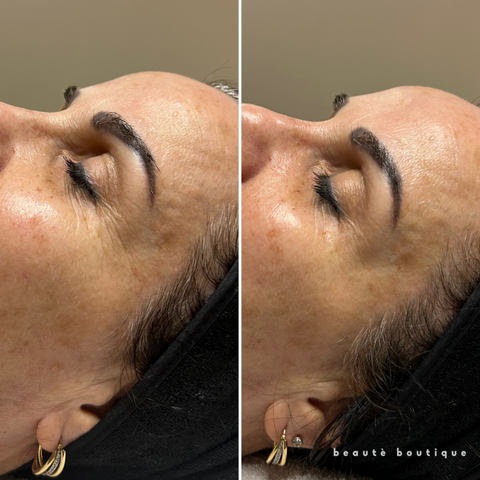 Signature Boutique Facial