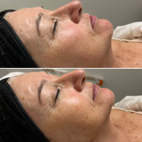 Signature Boutique Facial