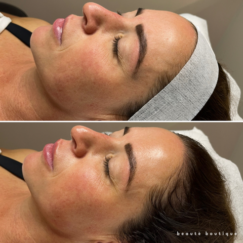 Signature Boutique Facial