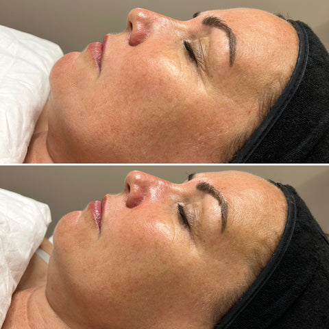 Signature Boutique Facial