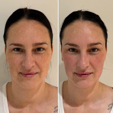 Buccal Sculpting Facial