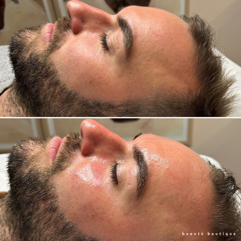 Gentlemens Express Facial