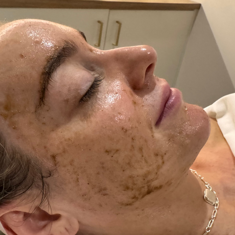skin health spicule facial